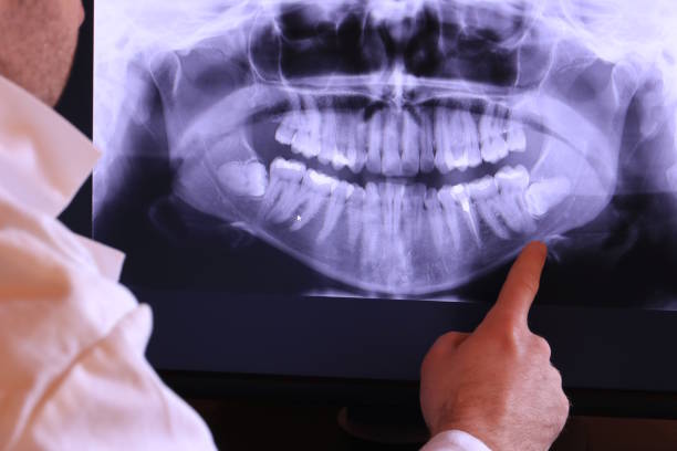 Best Cracked Tooth Emergency Dentist  in La Porte, TX